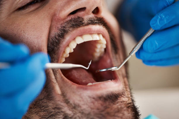 Best Emergency Treatment for Dental Infections or Abscesses in Pearl River, LA
