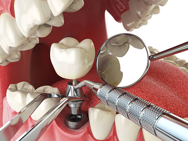 Best Same-Day Emergency Dental Services in Pearl River, LA